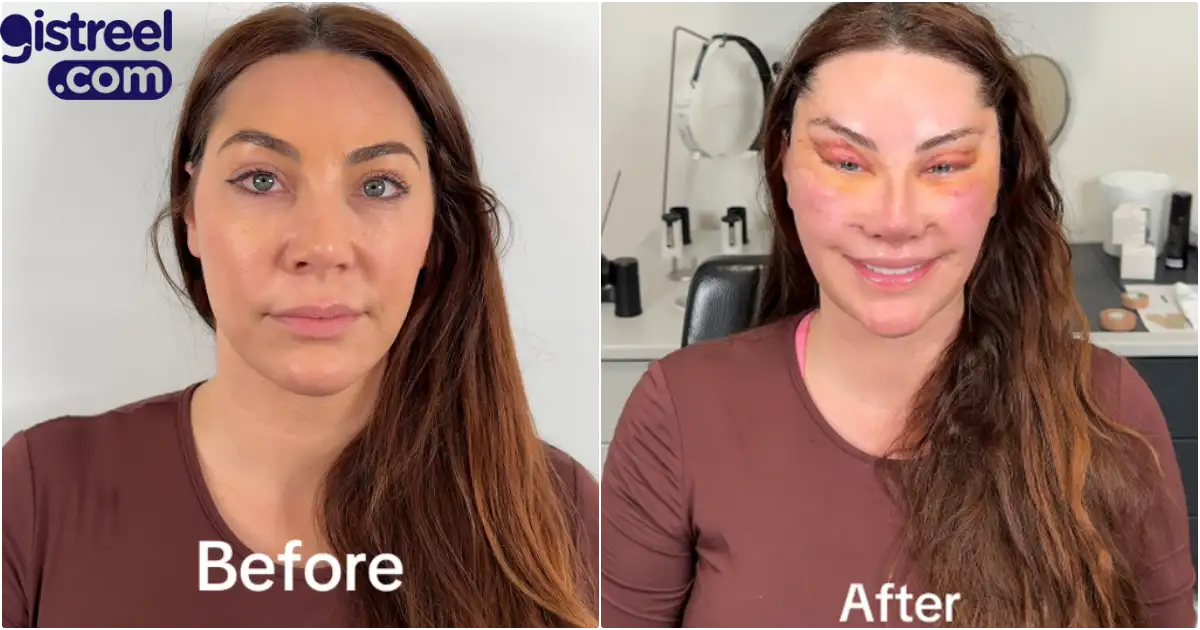 Lady's facial transformation after six surgeries sparks mixed reactions