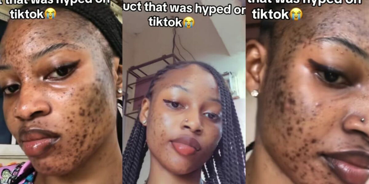 Lady shares shocking skin reaction after using hyped TikTok skincare product