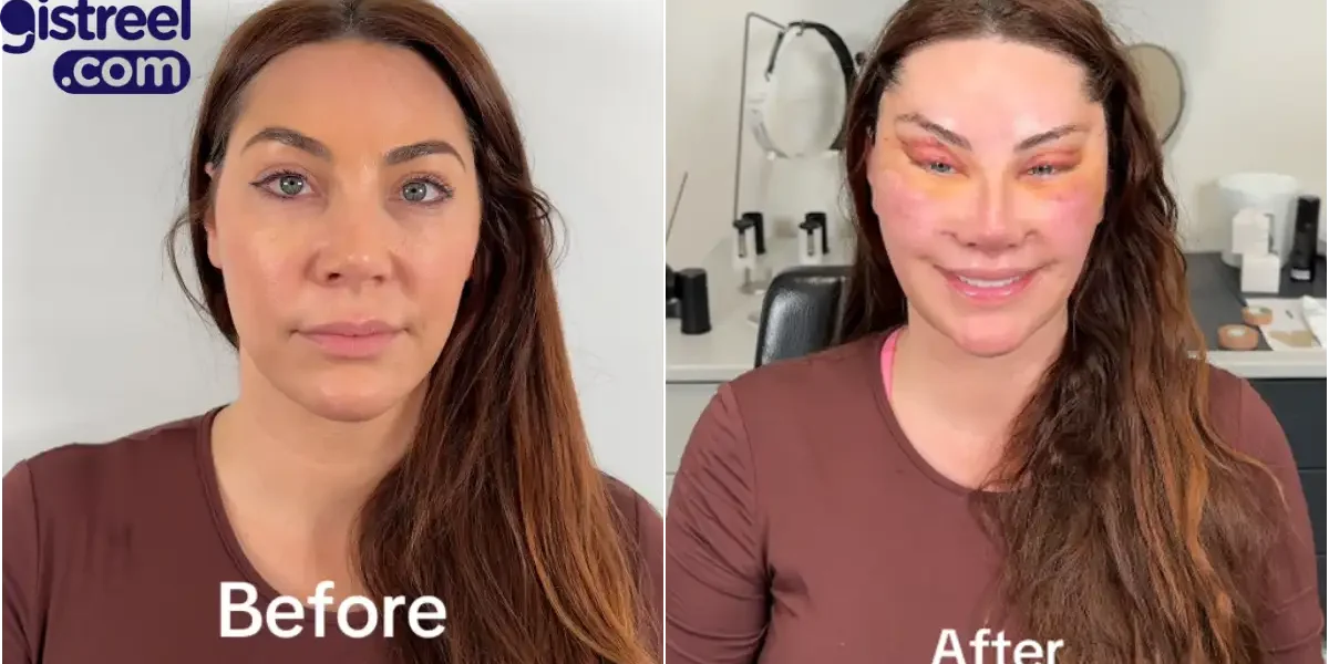 Lady's facial transformation after six surgeries sparks mixed reactions